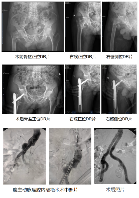 微信图片_20221114082327.png