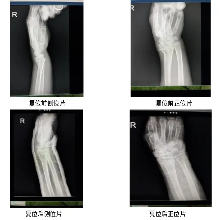 640.webp (62).png