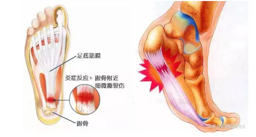 640 (1).webp (6).png